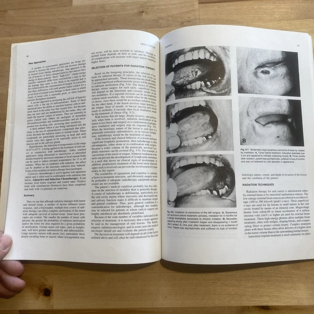 Oral‎ Cancer by Sol Silverman Jr 1985 American Cancer Society Second Edition